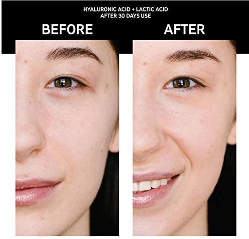 The Inkey List Face Serum And Cream Skincare Set! Hyaluronic Acid Serum And Vitamin C Cream! Antioxidant & Skin…