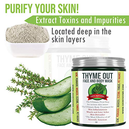 Thyme Out Face and Body Mask (8oz) - Anti-Inflammatory Formula Soothes Psoriasis, Acne and Facial Eczema - Quickly…